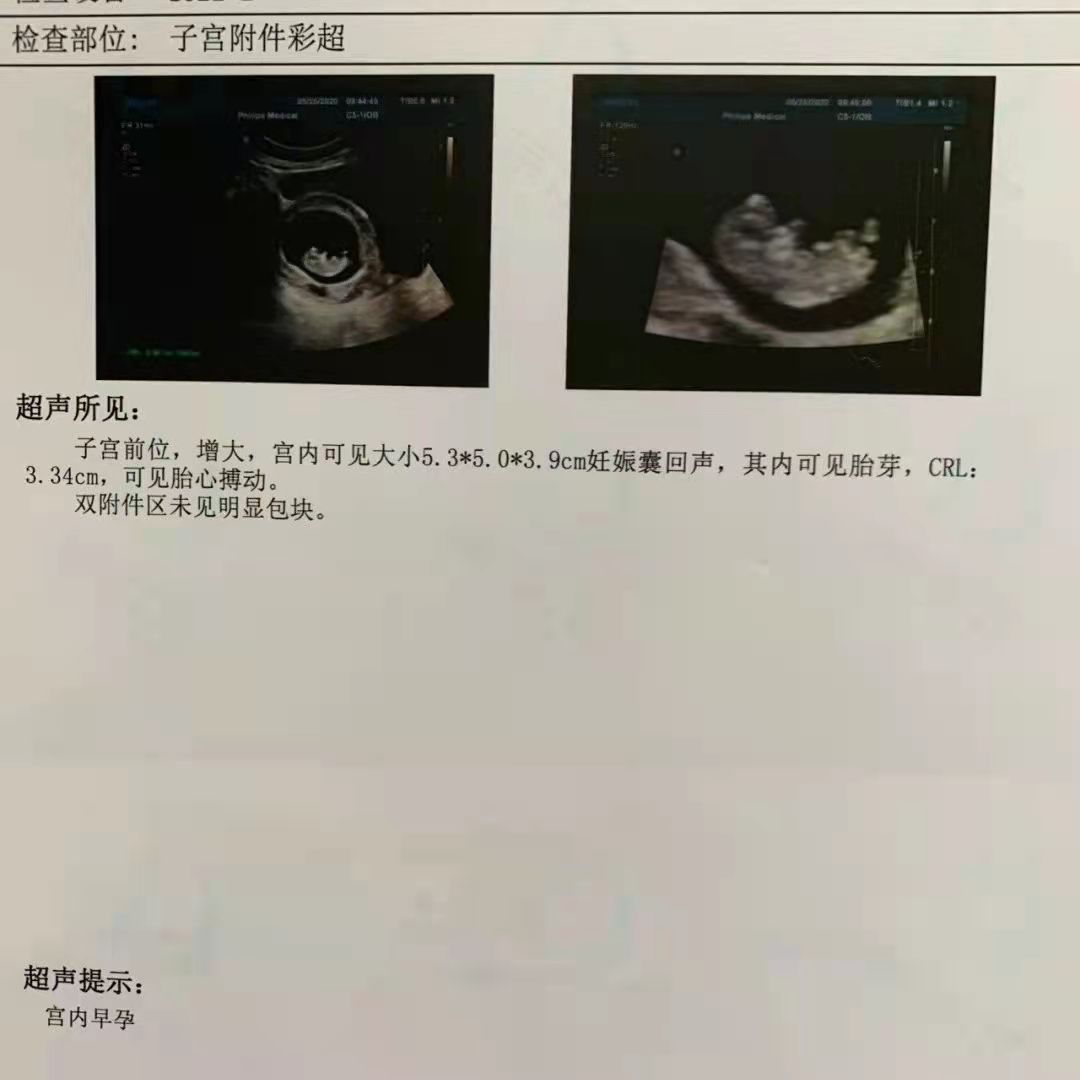 成都妇产孕检报告